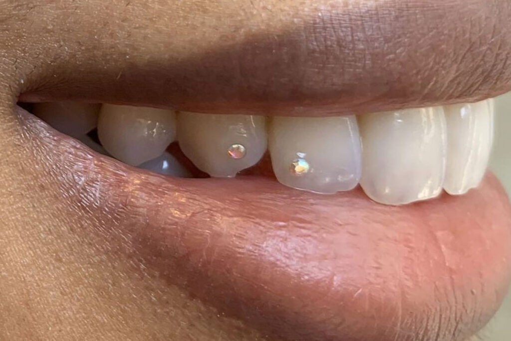 Diamond Dentist® Beverly Hills Dental Arts in Beverly Hills, CA