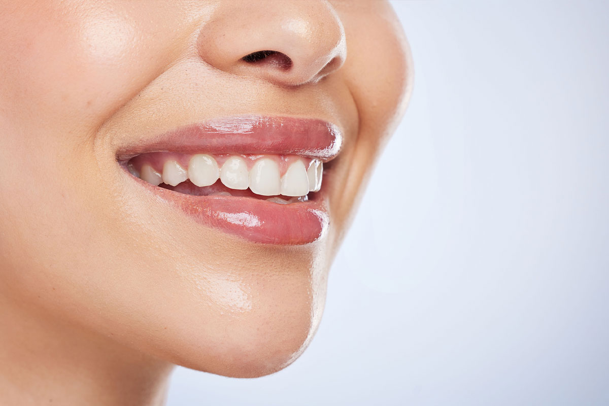 Laser Gum Contouring: Sculpting a Beautiful, Balanced Smile